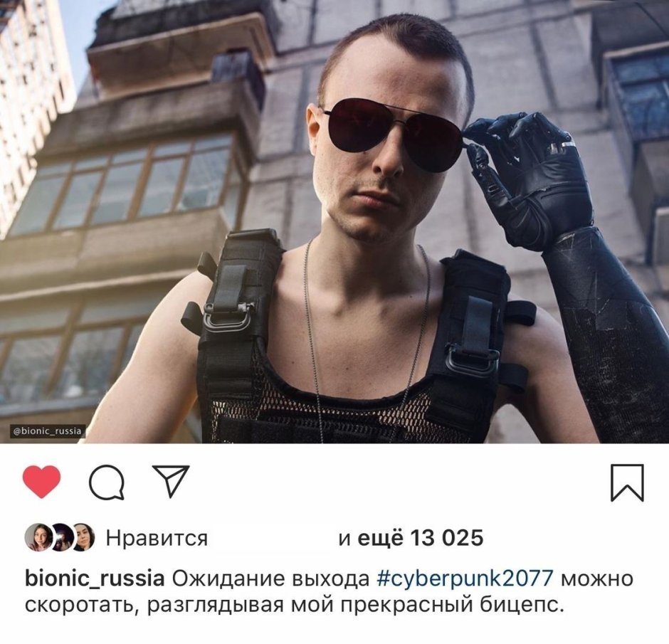 Тимур Сайфутдинов протезы